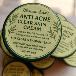 Anti Acne Cream -Blossom Auras